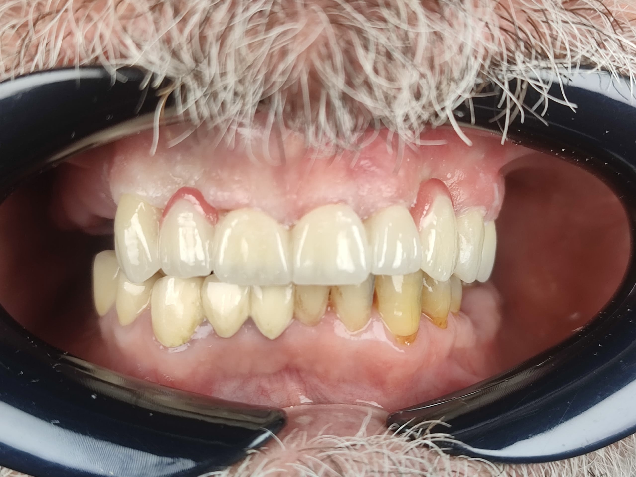 After dental treatment
