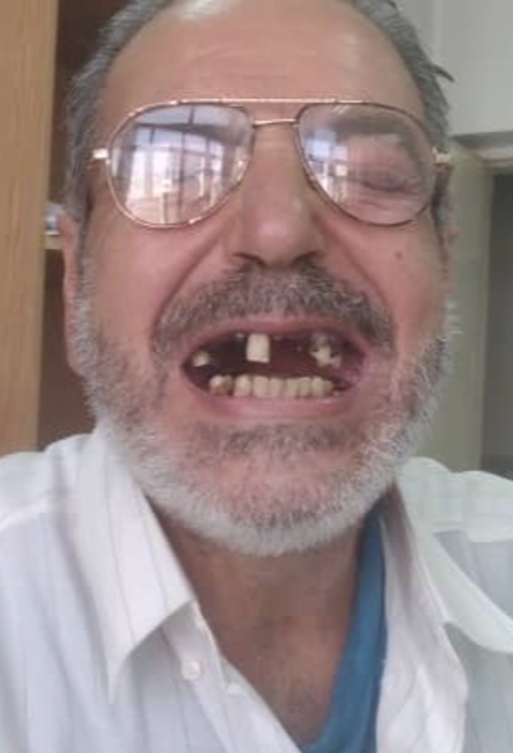 Before dental treatment
